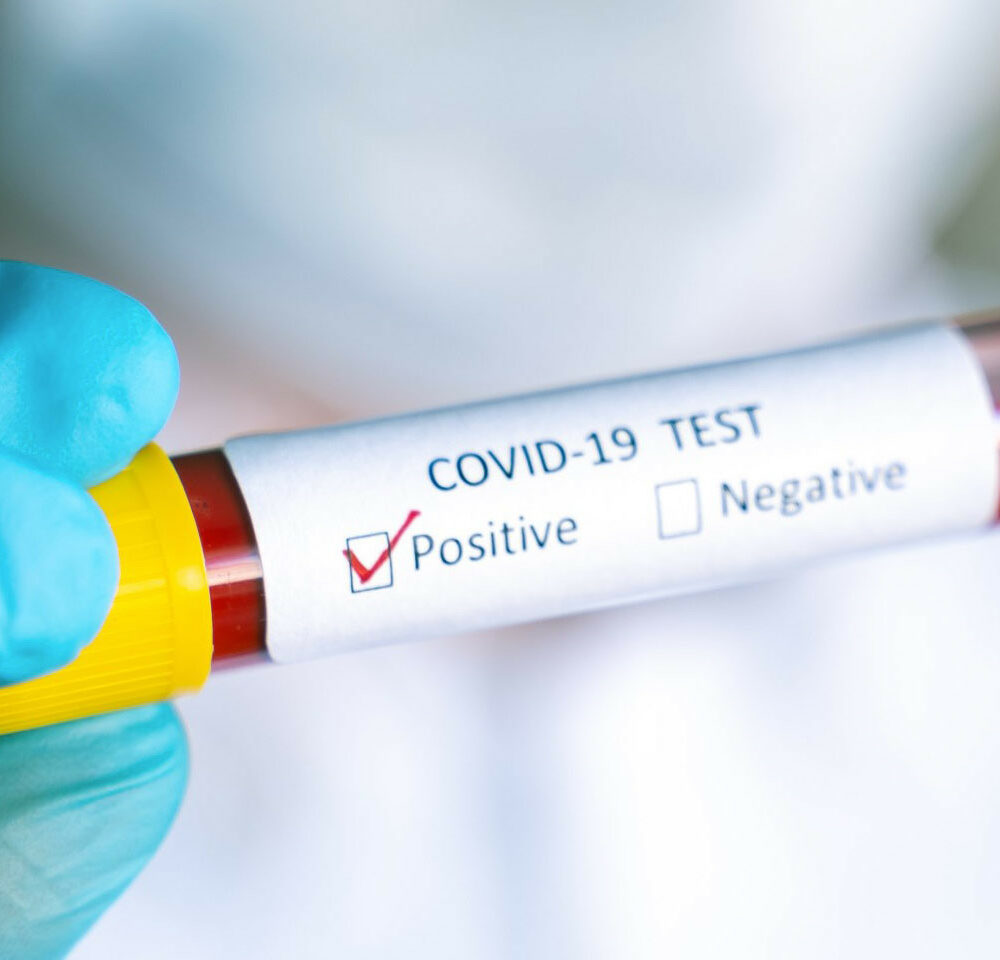 Test per il Coronavirus: disponibile dal 29 aprile a Padova
